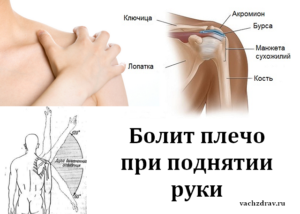 правая рука отекла от кисти до плеча болит причины