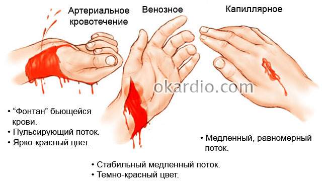 правила оказания первой медицинской помощи при травмах ушибах кровотечениях