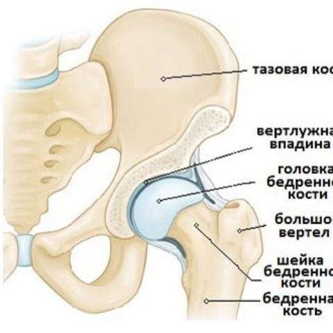 закрытый латеральный перелом шейки бедра со смещением