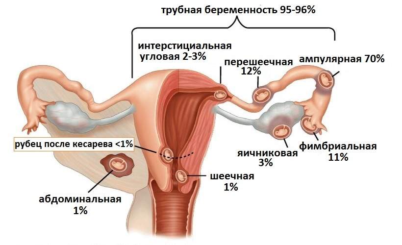 боли внизу живота и пояснице и отеки