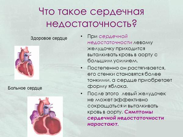 диета при отеках ног при сердечной недостаточности