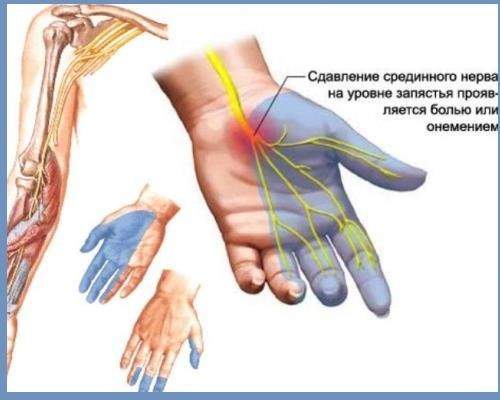 отек и гипертермия воспаление на кисти руки