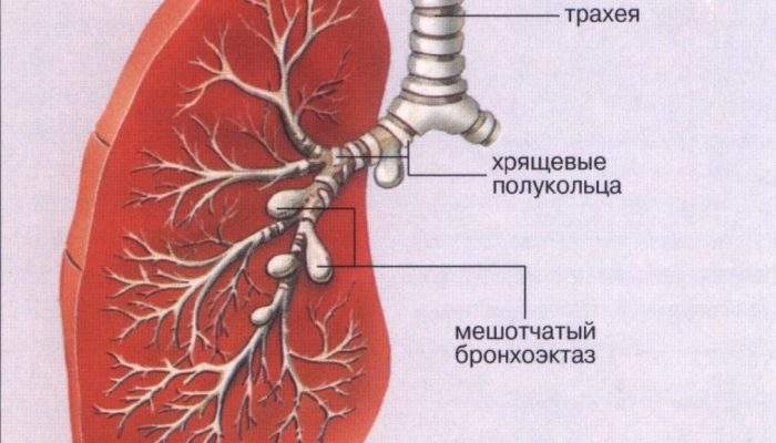 отек легких и сердечная астма дифференциальная диагностика