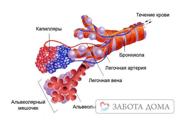 отек легких у лежачих больных что делать