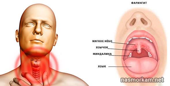 отек в горле при простуде что делать