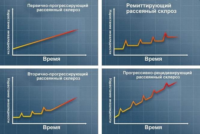 отеки при рассеянном склерозе из за чего