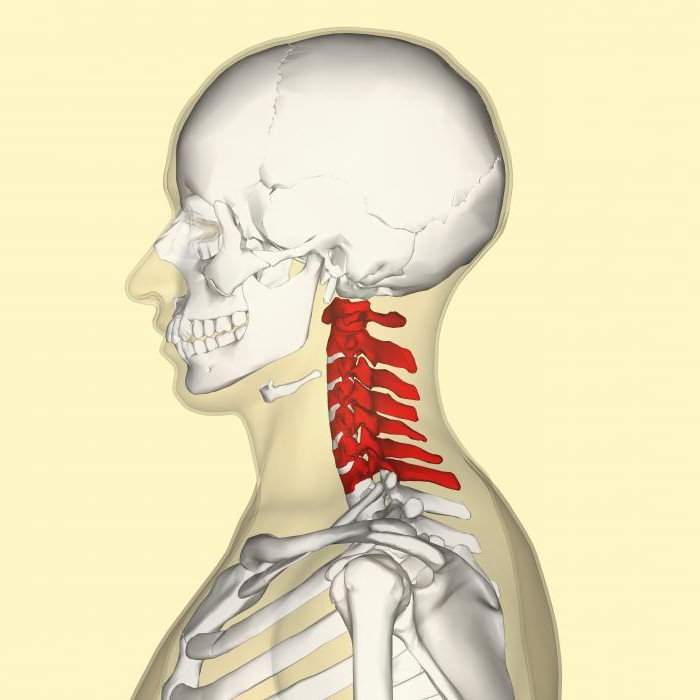 перелом 1 шейного позвонка как быстро срастается