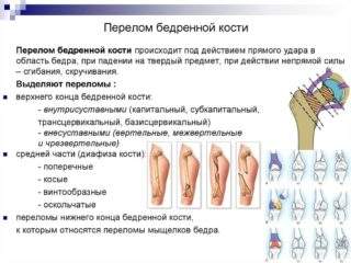 перелом бедра у ребенка сколько лежат вытяжении