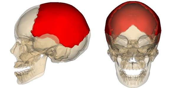 перелом теменной кости и ушиб головного мозга