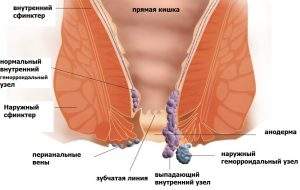 варикоз геморрой отеки практикуйте эти 4 упражнения и болезнь отступит