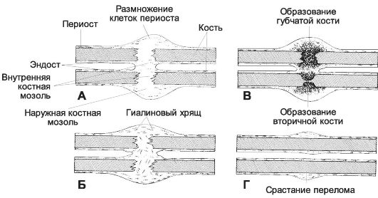 что делать если перелом руки не срастается