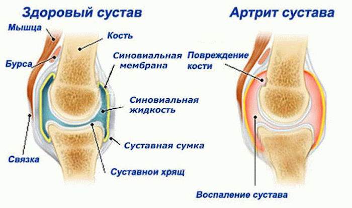 отекла нога внизу где косточка между голенью и стопой