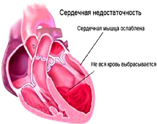 зуд ступней ног в ночное время и красные отеки