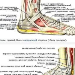 Верхний удерживатель сухожилий разгибателей болит и отек