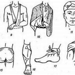 Какую повязку накладывают при ушибе плечевого сустава накладывают повязку?