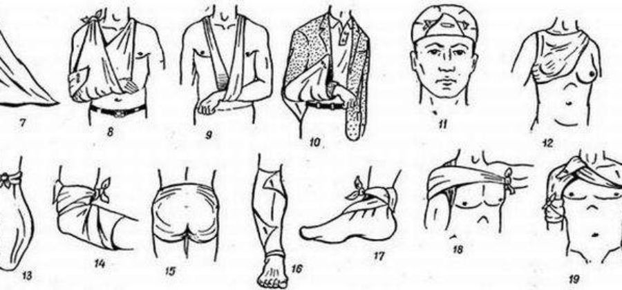 Перевязка косынка. Косыночная повязка техника наложения. Техника наложения косыночной повязки на различные части тела. Десмургия косыночныеповязка. Косыночная повязка показания.