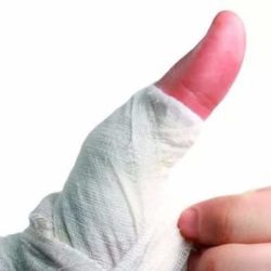 Как снять отек с пальцев рук после операции?