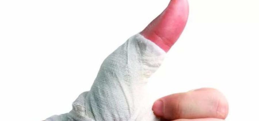 Как снять отек с пальцев рук после операции?