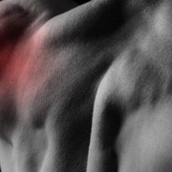 Вывих сухожилия длинной головки двуглавой мышцы плеча