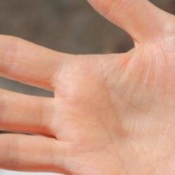 Воспаление сустава на пальце руки после ушиба лечение