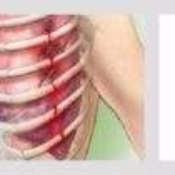 Ушиб грудной клетки симптомы и лечение в домашних условиях