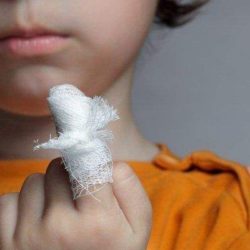Ребенок прищемил палец дверью перелом или ушиб