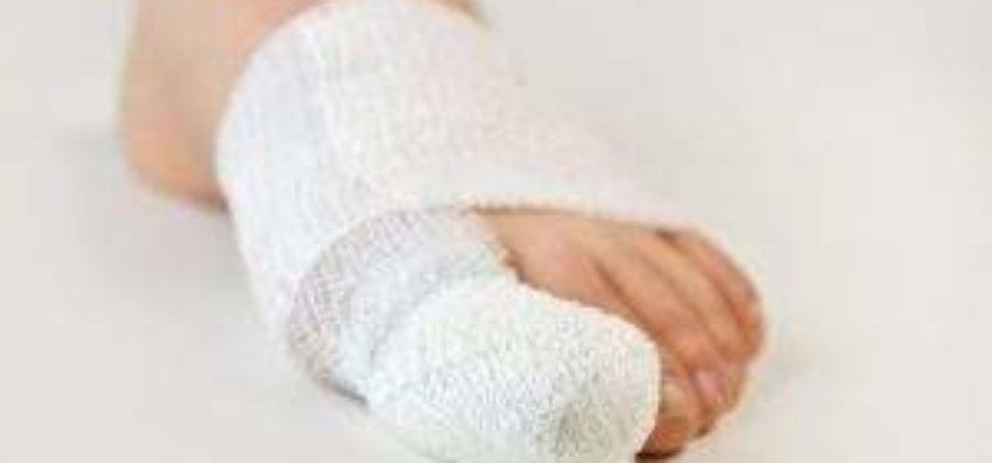 Как лечить ушиб пальца ноги с отеком в домашних условиях?
