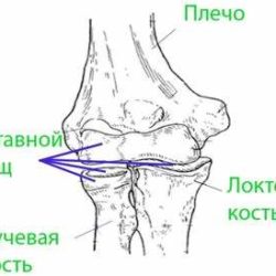 При ушибе локтевого сустава сколько ходить в гипсе