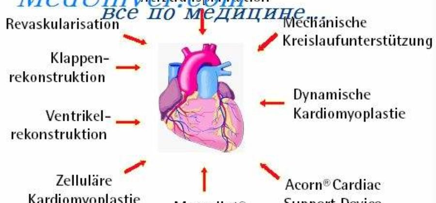 Отек легких и сердечная астма дифференциальная диагностика