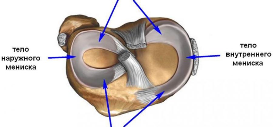 Перелом мениска коленного сустава лечение без операции