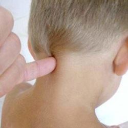 Вывих шеи у ребенка симптомы и лечение