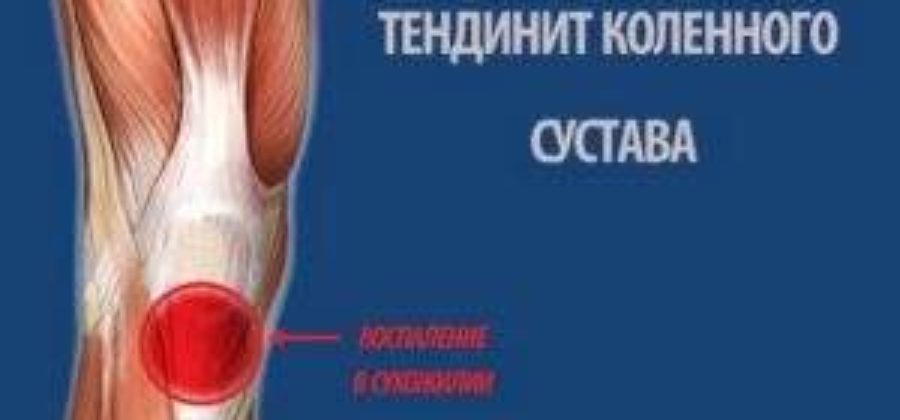 Боль и отек в коленном суставе лечение