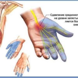 Отек и гипертермия воспаление на кисти руки