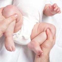 Вывих и подвывих тазобедренного сустава у новорожденных