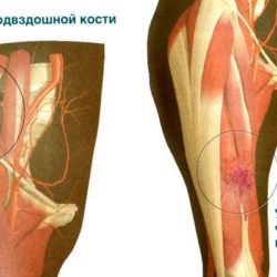 Перечислите действия которые необходимо совершить при ушибе бедра