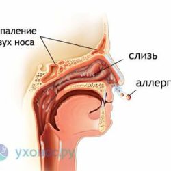 Причины отека слизистой носа и затрудненного дыхания