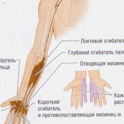 Защемление нерва после перелома лучевой кости лечение