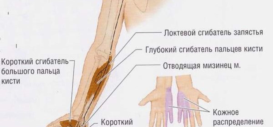 Защемление нерва после перелома лучевой кости лечение