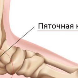 Какие признаки перелома или трещины на пятки?