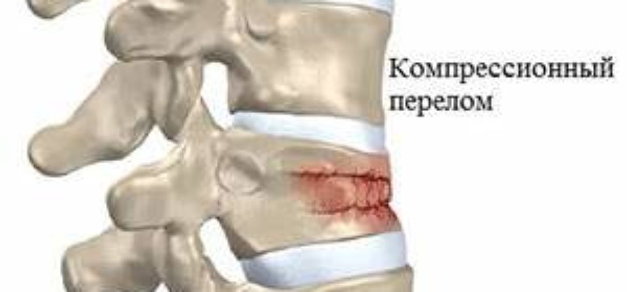 Физиолечение при компрессионном переломе позвоночника у детей