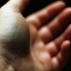 Как в домашних условиях лечить ушиб руки в домашних условиях?