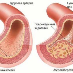 У детей с нарушением кровообращения появление отеков начинается с