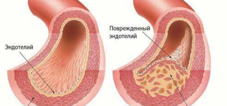 У детей с нарушением кровообращения появление отеков начинается с