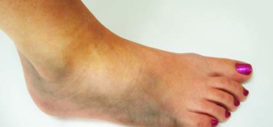 Дают ли больничный при ушибе пальца на ноге