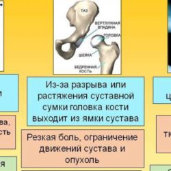 Можно ли вправлять вывих пострадавшему при оказании первой помощи?