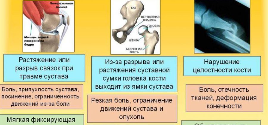 Можно ли вправлять вывих пострадавшему при оказании первой помощи?