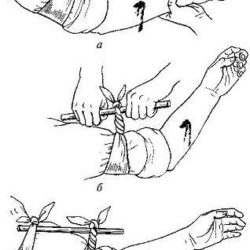 Оказание первой доврачебной помощи при ранениях и ушибах