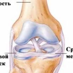 Мазь для лечения повреждения мениска и от отека