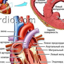 Отек легкого при болезни сердца постинфарктный кардиосклероз