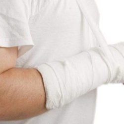 Как узнать в домашних условиях перелом руки?